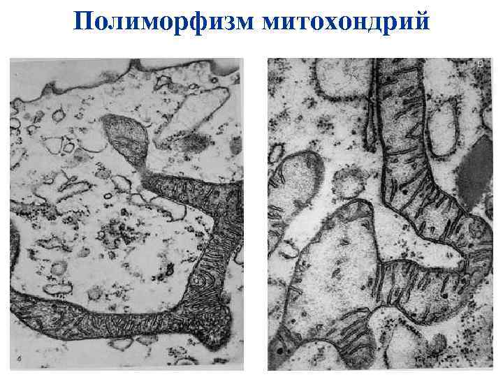 Полиморфизм митохондрий 