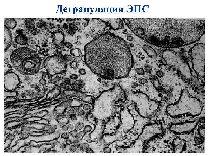 Дегрануляция ЭПС 