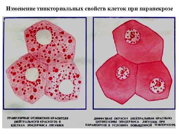 Изменение тинкториальных свойств клеток при паранекрозе 