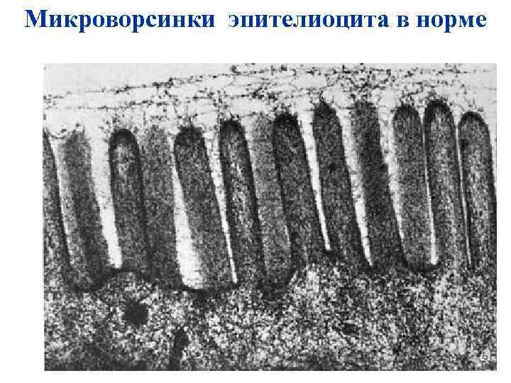 Микроворсинки эпителиоцита в норме 