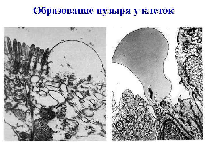 Образование пузыря у клеток 