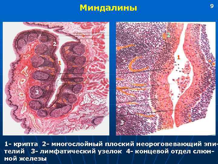 Увеличение слюнных желез фото