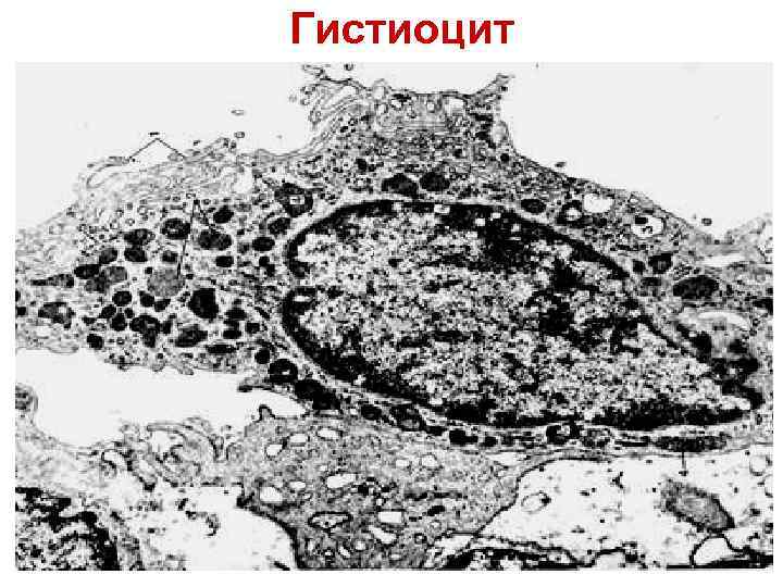 Накопление краски в макрофагах РВСТ Гистиоцит 