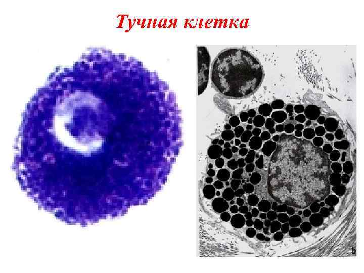 Тучная клетка 