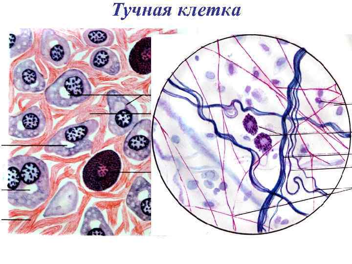 Тучная клетка 