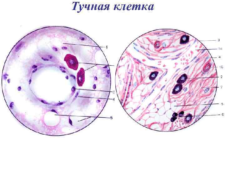 Тучная клетка 