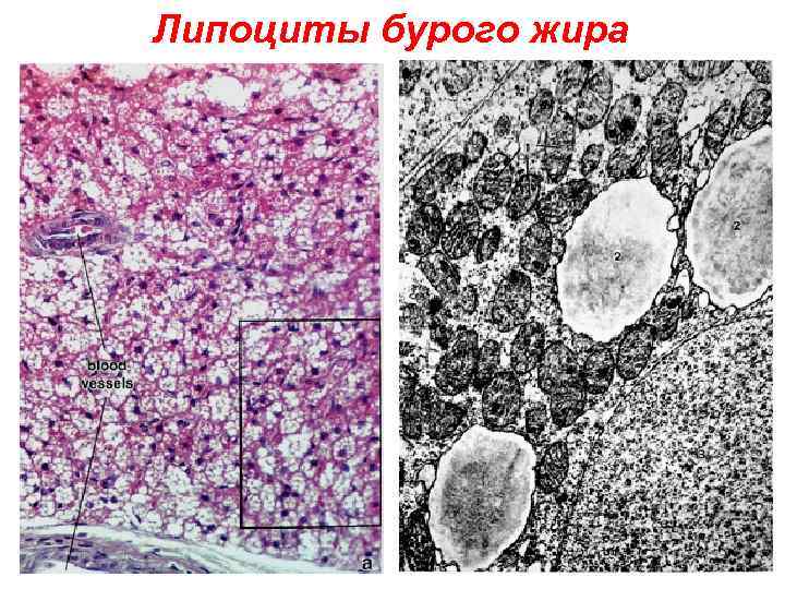 Липоциты бурого жира 