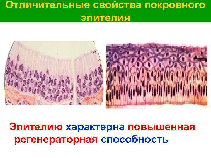 Отличительные свойства покровного эпителия Эпителию характерна повышенная регенераторная способность 