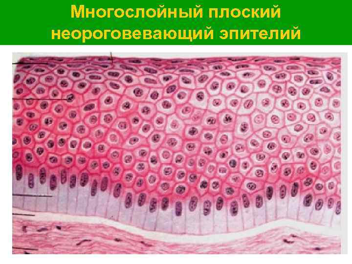Многослойный плоский неороговевающий эпителий 