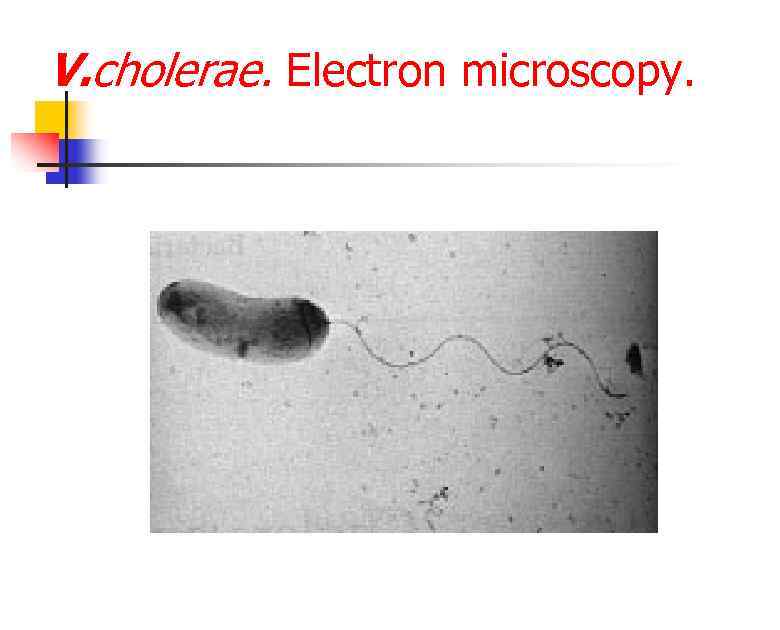 V. cholerae. Electron microscopy. 