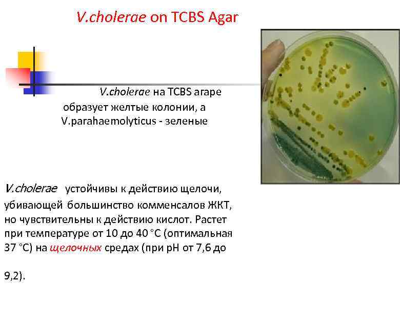 V. cholerae on TCBS Agar V. cholerae на TCBS агаре образует желтые колонии, а