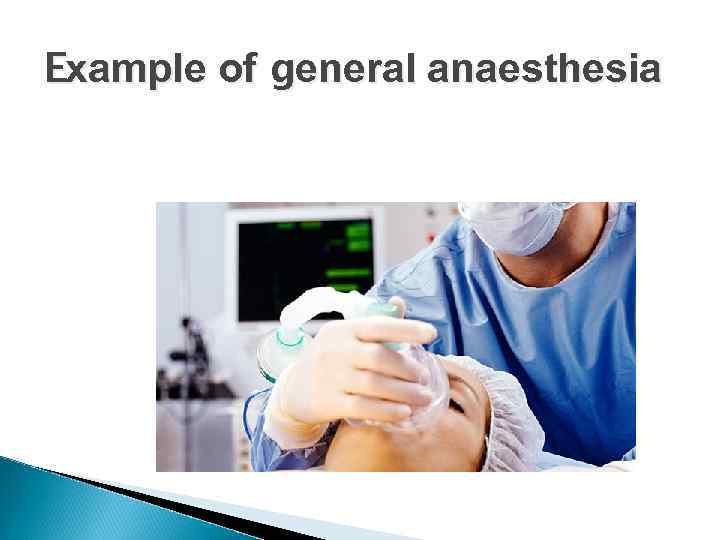 Example of general anaesthesia 