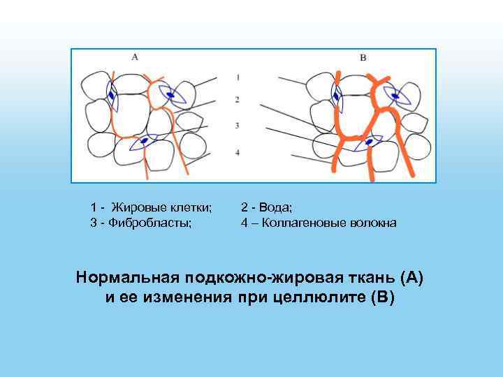 1 - Жировые клетки; 3 - Фибробласты; 2 - Вода; 4 – Коллагеновые волокна