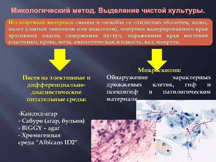 Микологический метод. Выделение чистой культуры. Исследуемый материал: смывы и соскобы со слизистых оболочек, кожи,