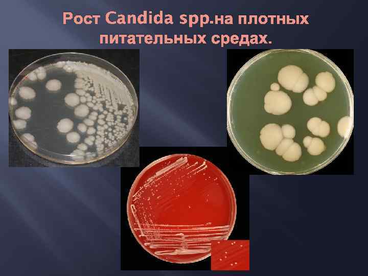 Рост Candida spp. на плотных питательных средах. 