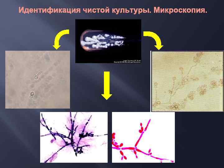 Идентификация чистой культуры. Микроскопия. 