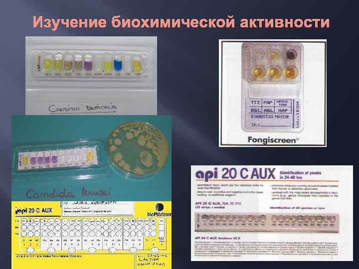 Изучение биохимической активности 