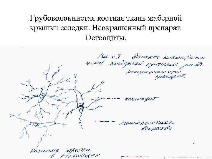 Грубоволокнистая костная ткань жаберной крышки селедки. Неокрашенный препарат. Остеоциты. 