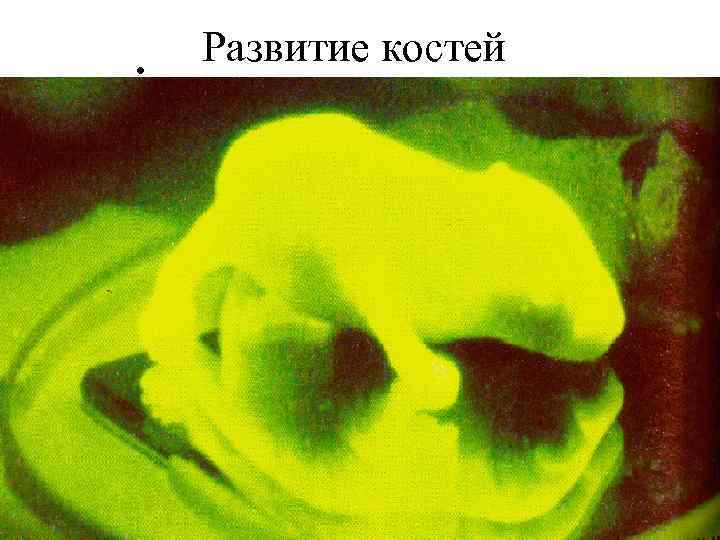  • Развитие костей 