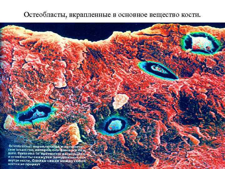 Остеокласты и остеобласты картинки