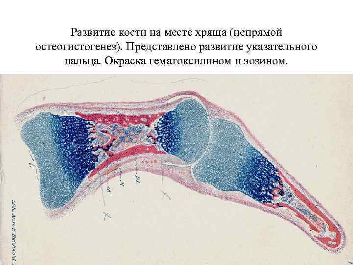 Развитие кости на месте хряща (непрямой остеогистогенез). Представлено развитие указательного пальца. Окраска гематоксилином и