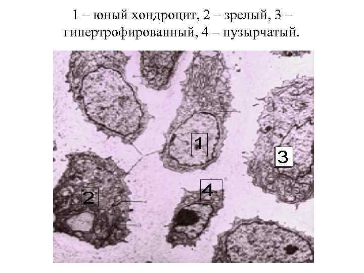 1 – юный хондроцит, 2 – зрелый, 3 – гипертрофированный, 4 – пузырчатый. 