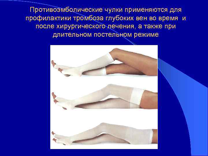 Противоэмболические чулки применяются для профилактики тромбоза глубоких вен во время и после хирургического лечения,
