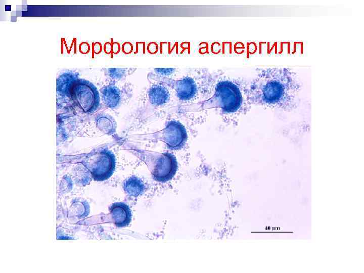 Морфология аспергилл 