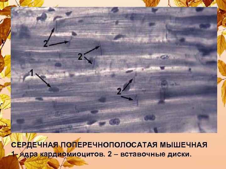 СЕРДЕЧНАЯ ПОПЕРЕЧНОПОЛОСАТАЯ МЫШЕЧНАЯ 1 - ядра кардиомиоцитов. 2 – вставочные диски. 
