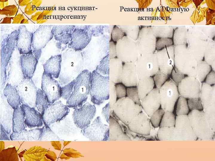 Реакция на сукцинатдегидрогеназу Реакция на АТФазную активность 