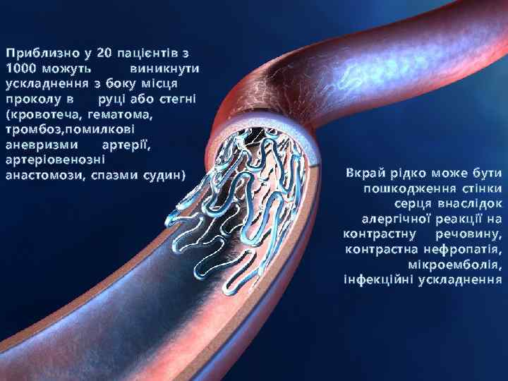 Приблизно у 20 пацієнтів з 1000 можуть виникнути ускладнення з боку місця проколу в