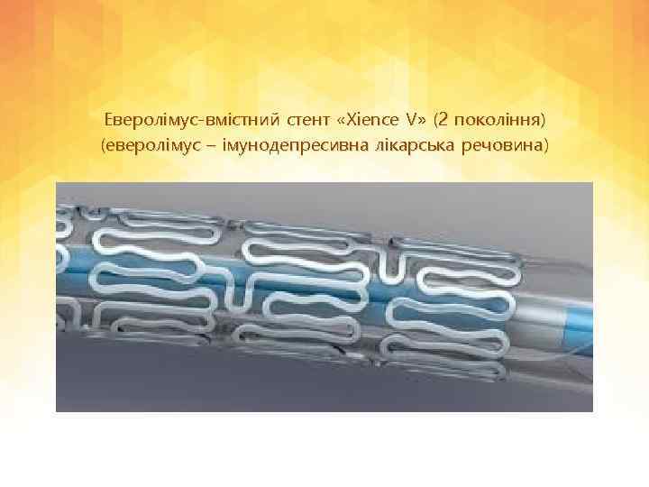 Еверолімус-вмістний стент «Xience V» (2 покоління) (еверолімус – імунодепресивна лікарська речовина) 