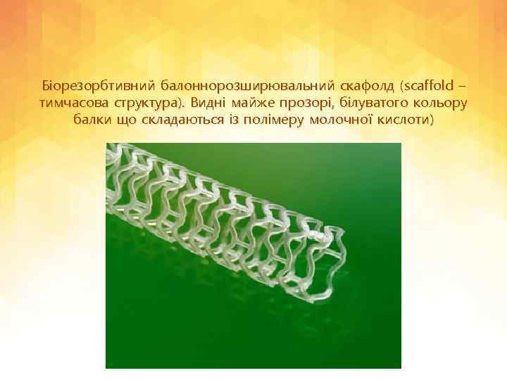 Біорезорбтивний балоннорозширювальний скафолд (scaffold – тимчасова структура). Видні майже прозорі, білуватого кольору балки що