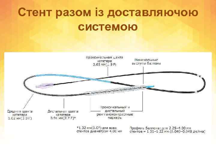 Стент разом із доставляючою системою 