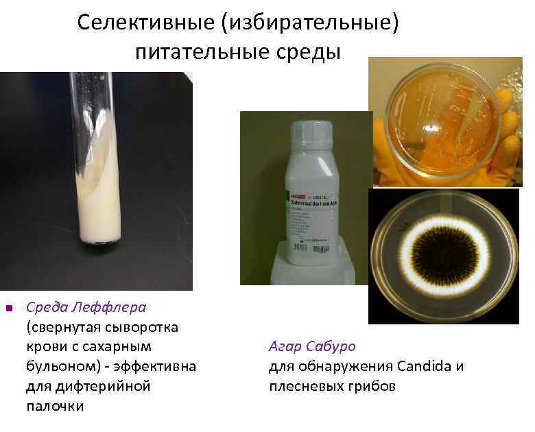 Селективные (избирательные) питательные среды n Среда Леффлера (свернутая сыворотка крови с сахарным бульоном) -