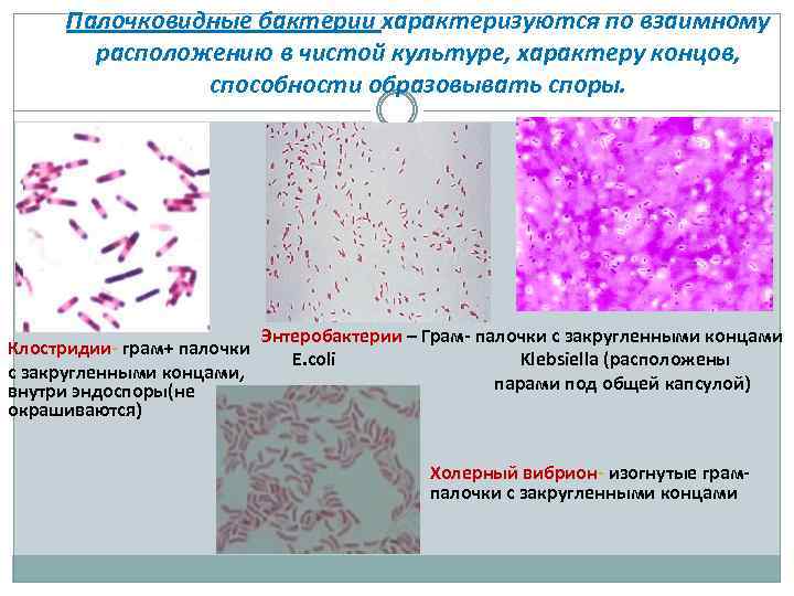 Палочковидные бактерии характеризуются по взаимному расположению в чистой культуре, характеру концов, способности образовывать споры.