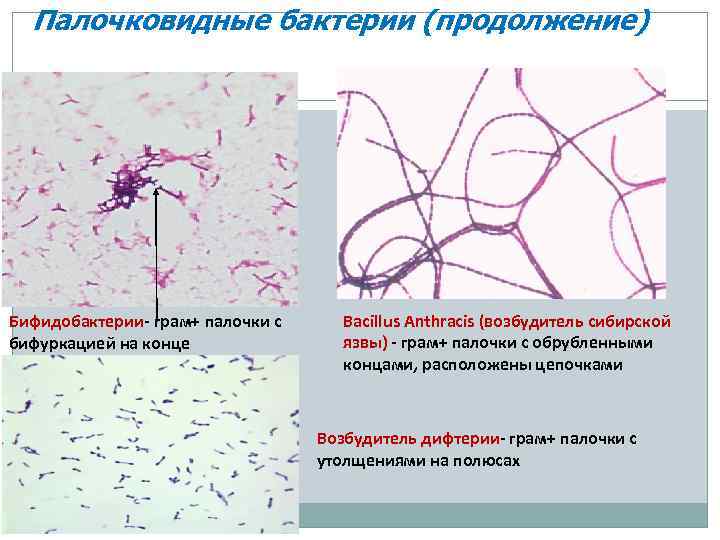 Нитевидные бактерии. Палочковидные бактерии располагающиеся в мазках цепочками. Палочковидные формы микроорганизмов. Классификация палочковидных микроорганизмов. Морфология палочковидных бактерий.