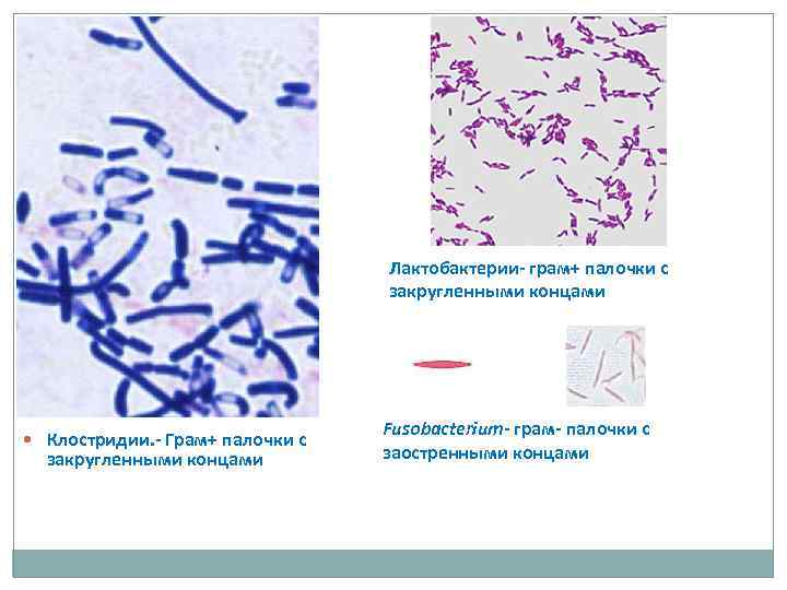 Грам палочки умеренное количество. Палочки бациллы грамположительные. Грамотрицательные спорообразующие палочки. Жгутиковые грамположительные палочки.. Лактобациллы морфология грамположительная.