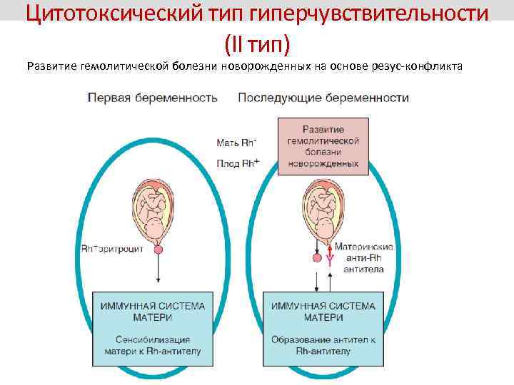 Цитотоксический тип гиперчувствительности (II тип) Развитие гемолитической болезни новорожденных на основе резус-конфликта 