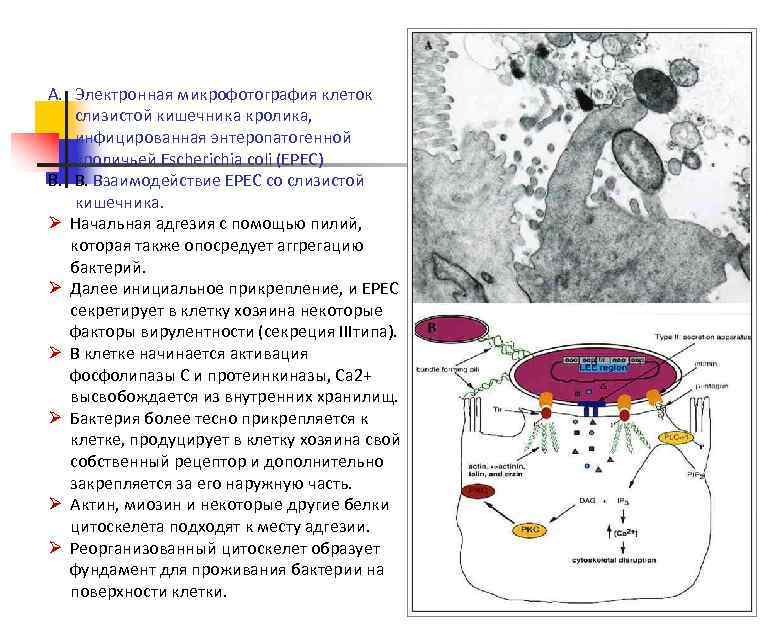 A. Электронная микрофотография клеток слизистой кишечника кролика, инфицированная энтеропатогенной кроличьей Escherichia coli (EPEC) B.