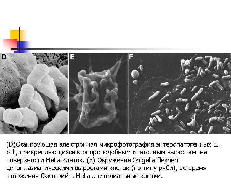 (D)Сканирующая электронная микрофотография энтеропатогенных Е. coli, прикрепляющихся к опороподобным клеточным выростам на поверхности He.
