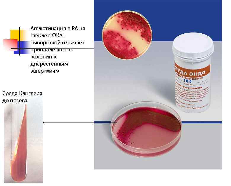 Агглютинация в РА на стекле с ОКАсывороткой означает принадлежность колонии к диареегенным эшерихиям Среда