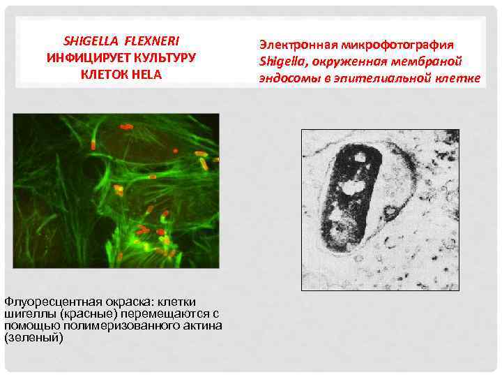 SHIGELLA FLEXNERI ИНФИЦИРУЕТ КУЛЬТУРУ КЛЕТОК HELA Флуоресцентная окраска: клетки шигеллы (красные) перемещаются с помощью