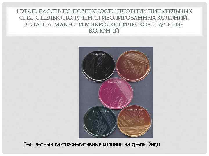 1 ЭТАП. РАССЕВ ПО ПОВЕРХНОСТИ ПЛОТНЫХ ПИТАТЕЛЬНЫХ СРЕД С ЦЕЛЬЮ ПОЛУЧЕНИЯ ИЗОЛИРОВАННЫХ КОЛОНИЙ. 2