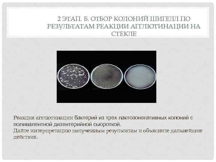 2 ЭТАП. Б. ОТБОР КОЛОНИЙ ШИГЕЛЛ ПО РЕЗУЛЬТАТАМ РЕАКЦИИ АГГЛЮТИНАЦИИ НА СТЕКЛЕ Реакция агглютинации