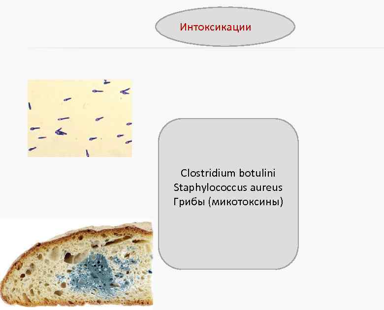 Интоксикации Clostridium botulini Staphylococcus aureus Грибы (микотоксины) 