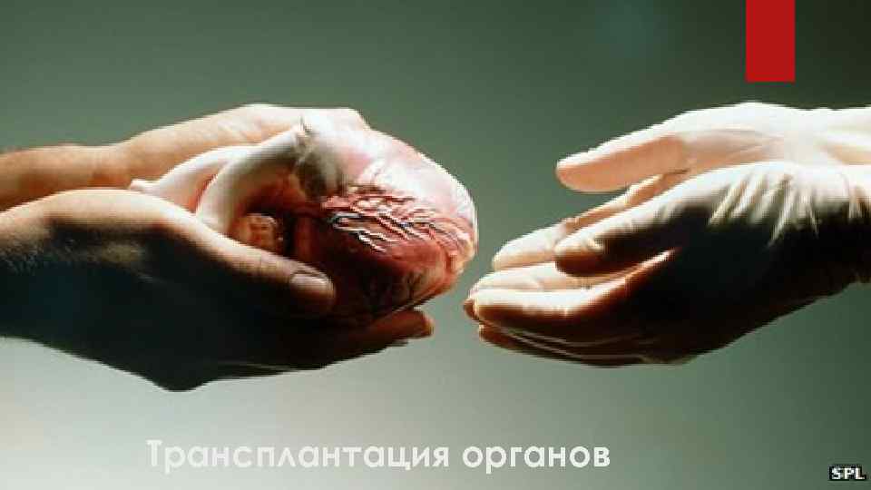 Трансплантация органов 