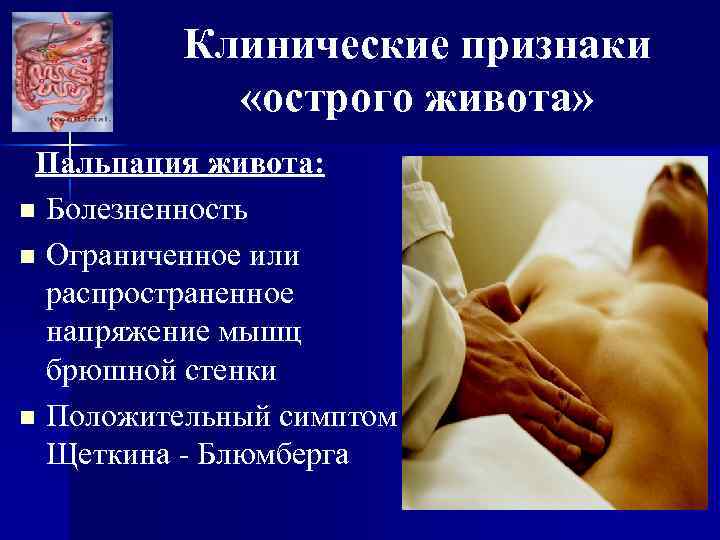 Клинические признаки «острого живота» Пальпация живота: n Болезненность n Ограниченное или распространенное напряжение мышц