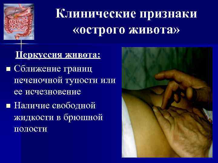 Клинические признаки «острого живота» Перкуссия живота: n Сближение границ печеночной тупости или ее исчезновение