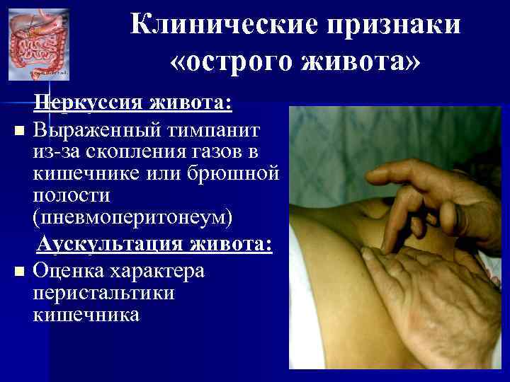 Клинические признаки «острого живота» Перкуссия живота: n Выраженный тимпанит из-за скопления газов в кишечнике